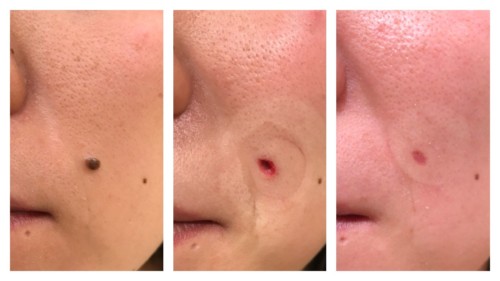 治療法と救済策