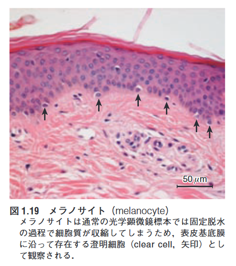 シミ 肝斑の取り方 レーザーや飲み薬 皮膚科専門医dr Miko