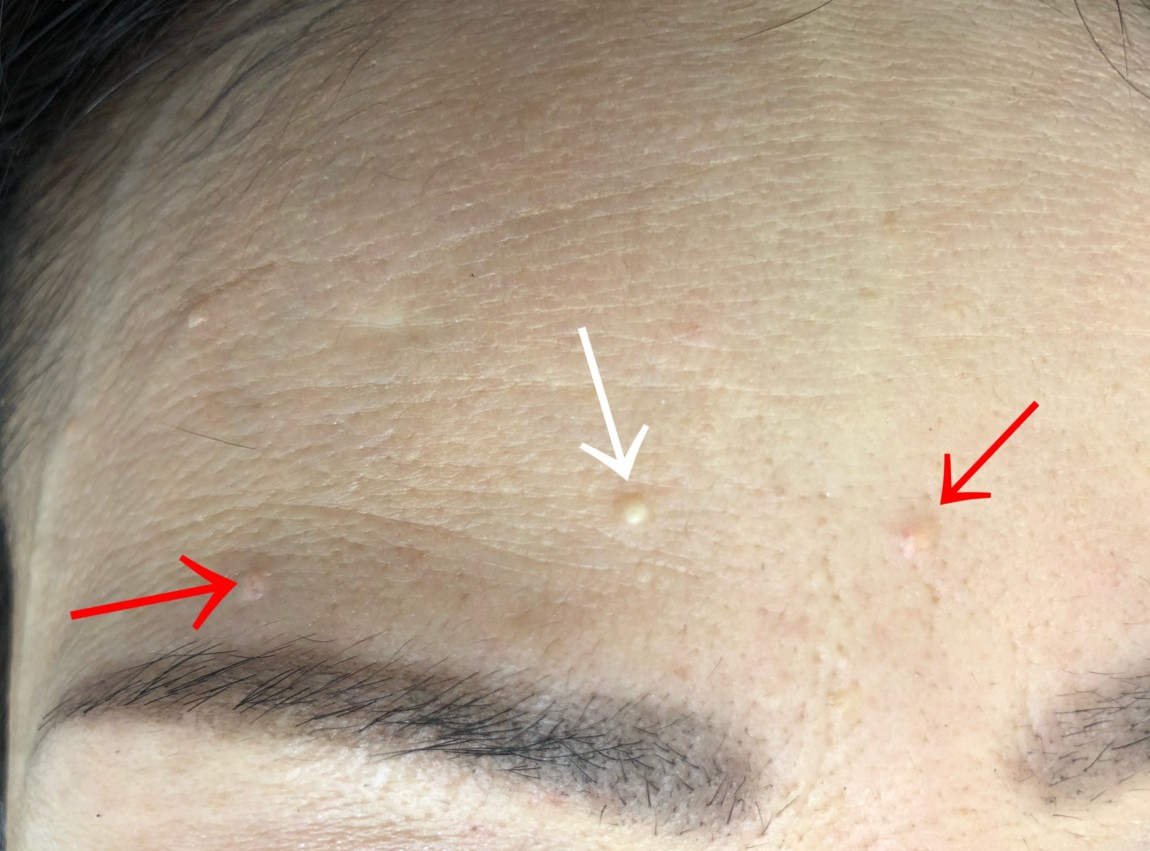 医師の診察を受ける時期